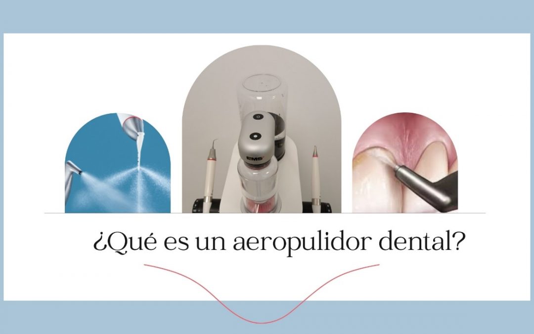 ¿Qué es un aeropulidor dental?
