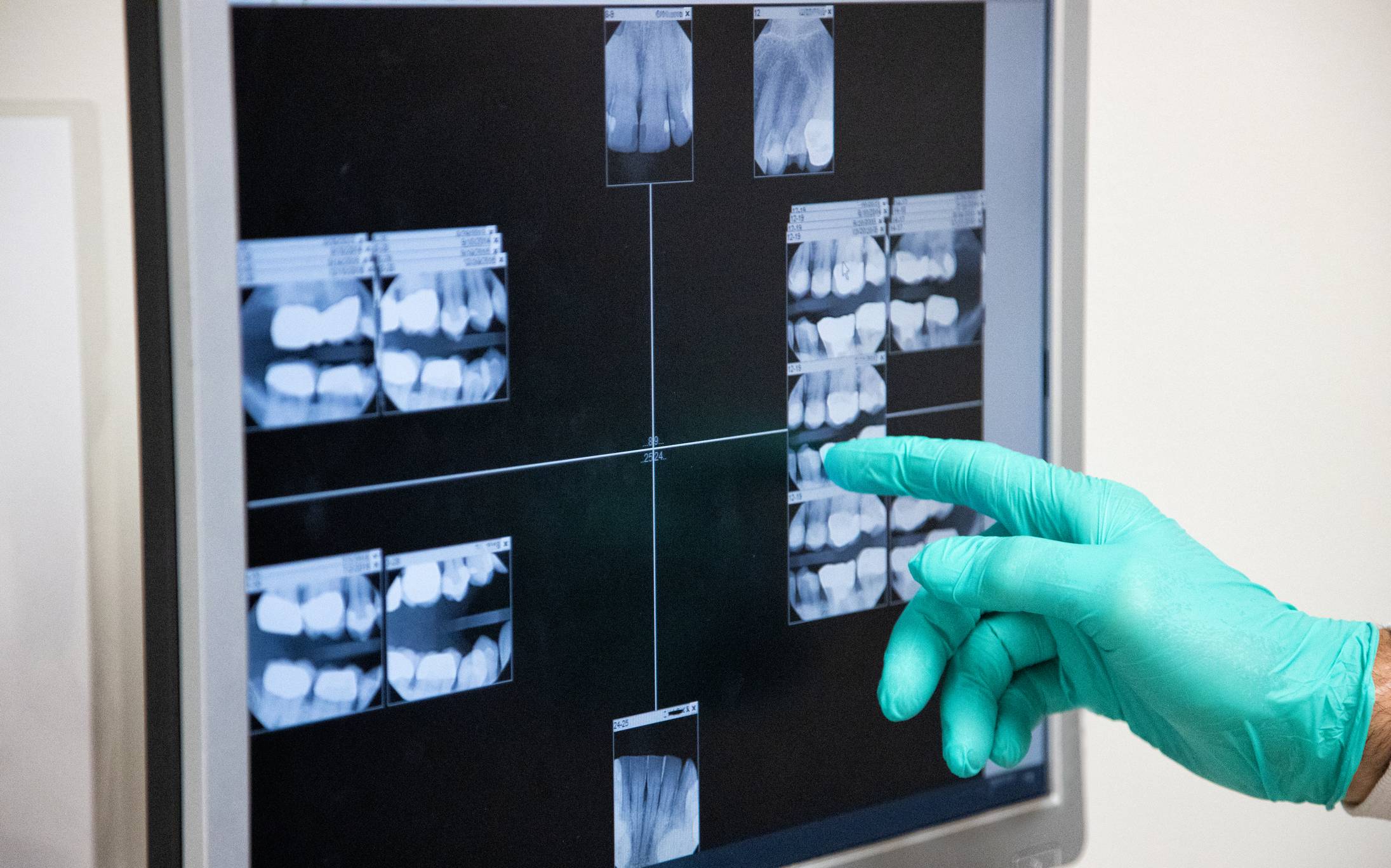 radiodiagnóstico dental en Alcorcón, radiografía dental en Alcorcón, cámara intraoral, radiografía digital en Alcorcón.