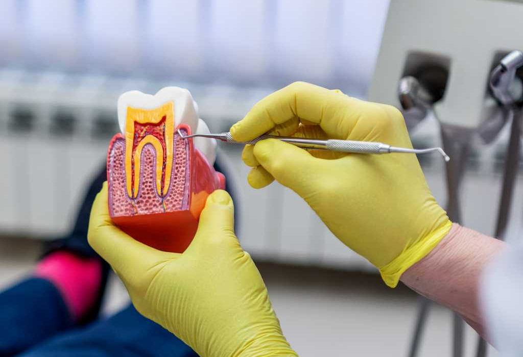 Endodoncia en Alcorcón, tratamiento de conductos en Alcorcón, endodoncista en Alcorcón.