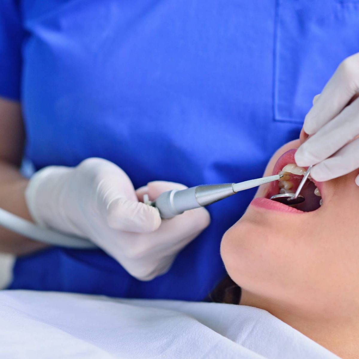 Periodoncia en Alcorcón, tratamiento para las encías en Alcorcón, sangrado de encías.
