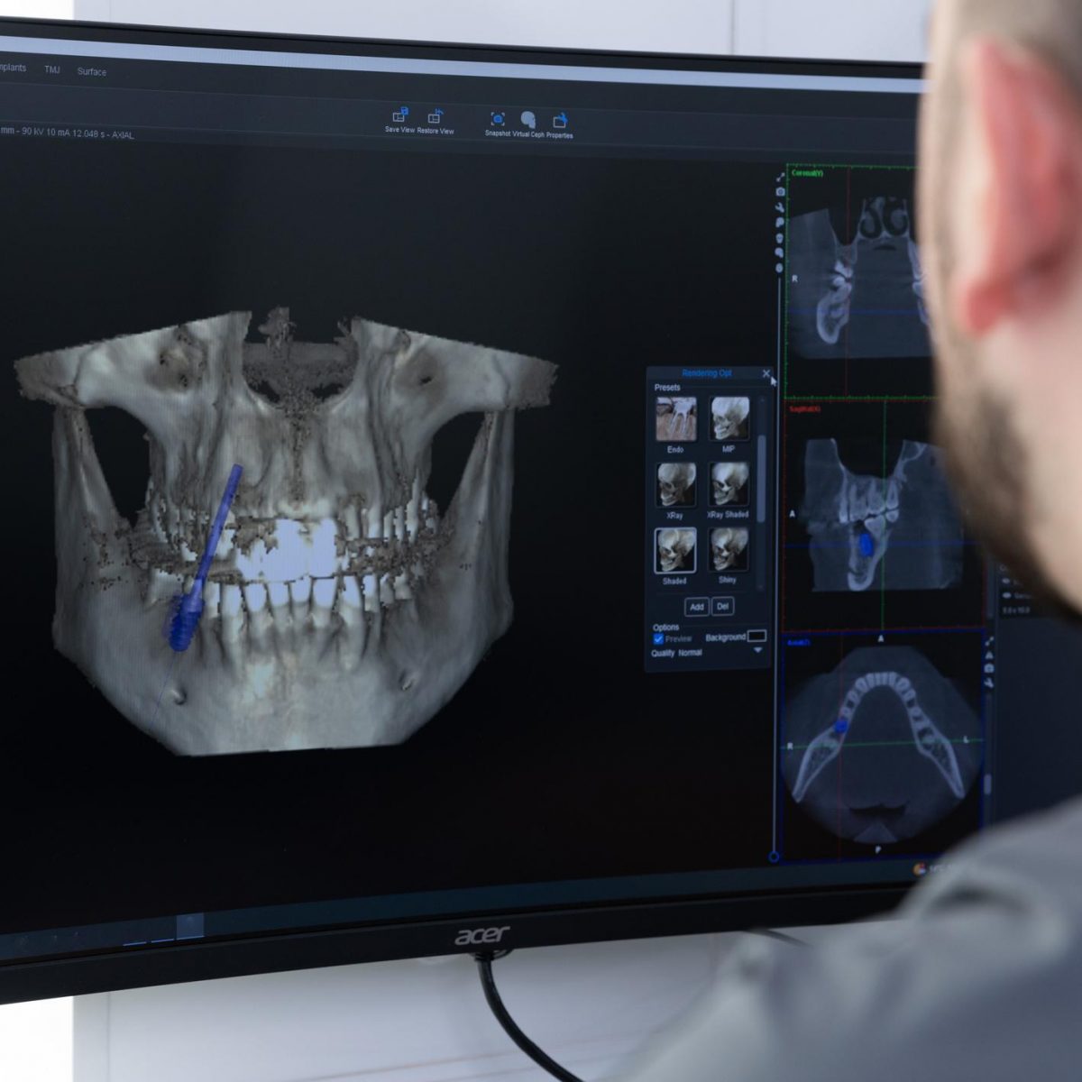 radiodiagnóstico dental en Alcorcón, radiografía dental en Alcorcón, cámara intraoral, radiografía digital en Alcorcón.